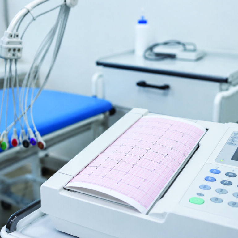 ECG Services