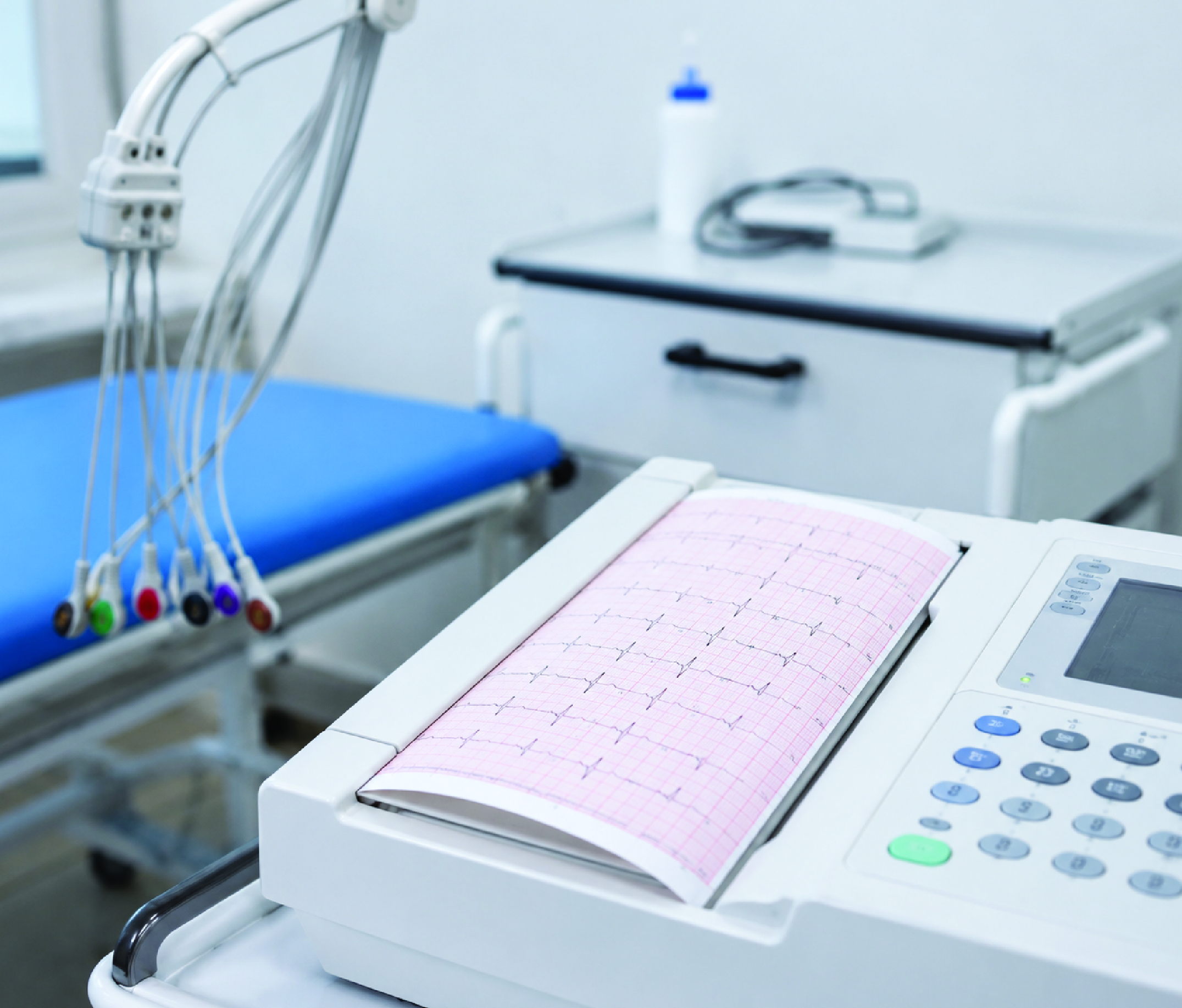 ECG Services